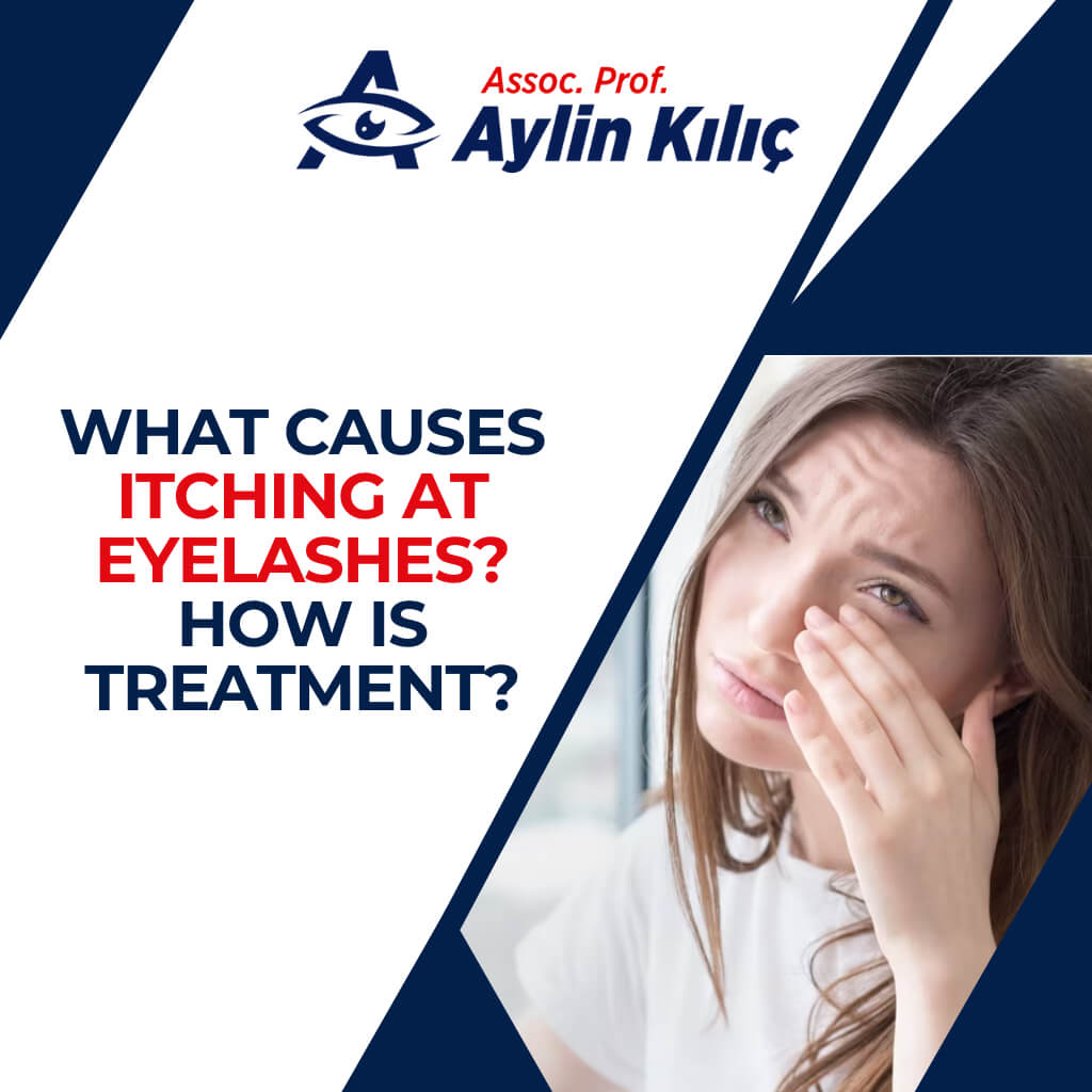 What causes itching at eyelashes How is treatment