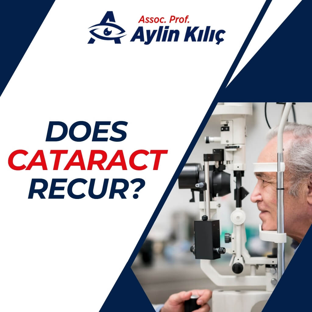Does Cataract Recur