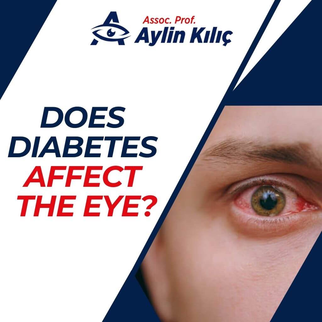 Does Diabetes Affect the EyeENG 1