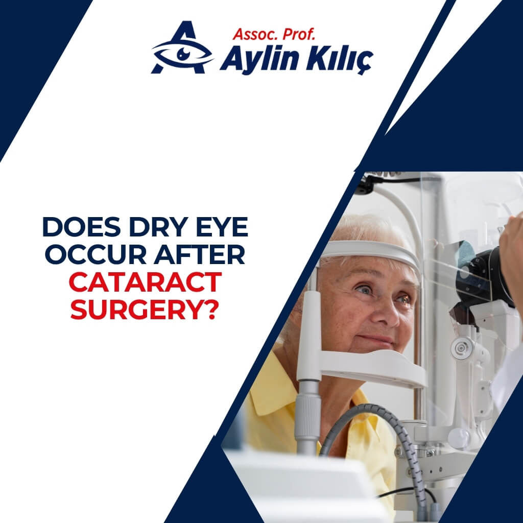 Does Dry Eye Occur After Cataract Surgery
