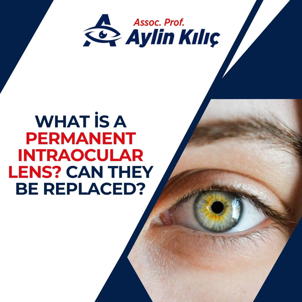 What is a Permanent Intraocular Lens