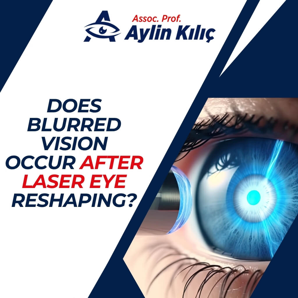Does Blurred Vision Occur After Laser Eye Reshaping