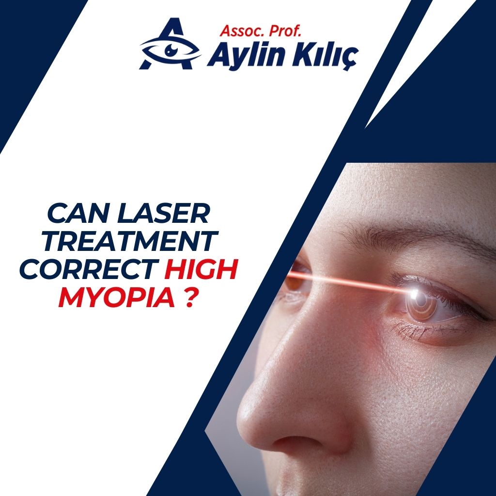 Can Laser Treatment Correct High Myopia ?