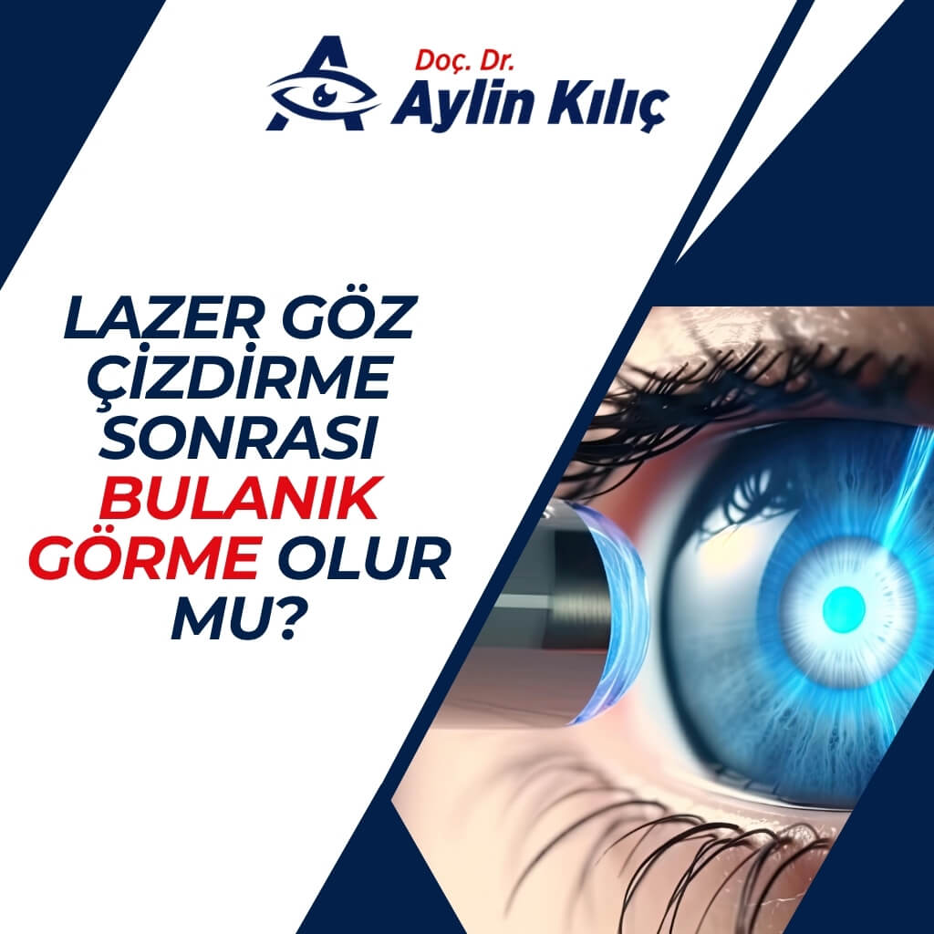 Lazer Göz Çizdirme Sonrası Bulanık Görme Olur mu-turkce (1)