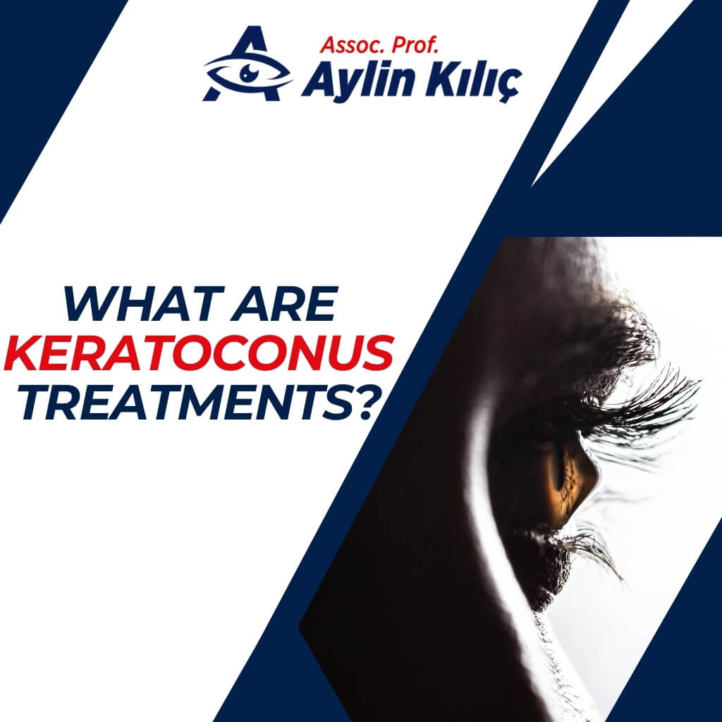 What are Keratoconus TreatmentsENG 1