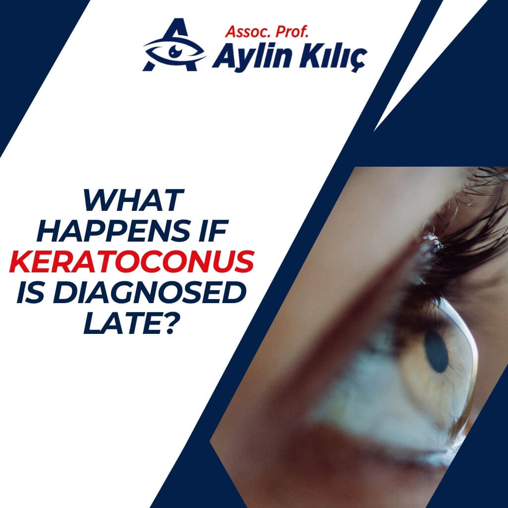 What happens if keratoconus is diagnosed late