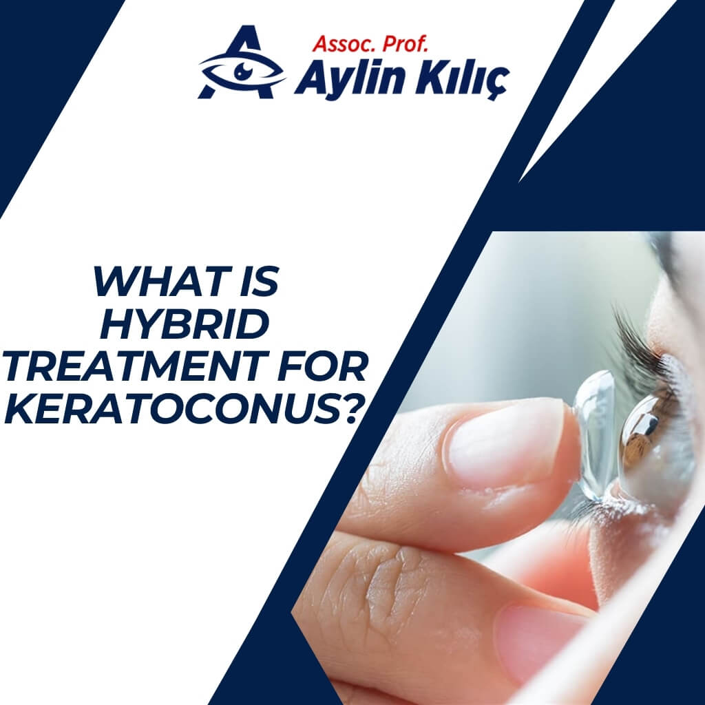 What is Hybrid Treatment for Keratoconus 2 1