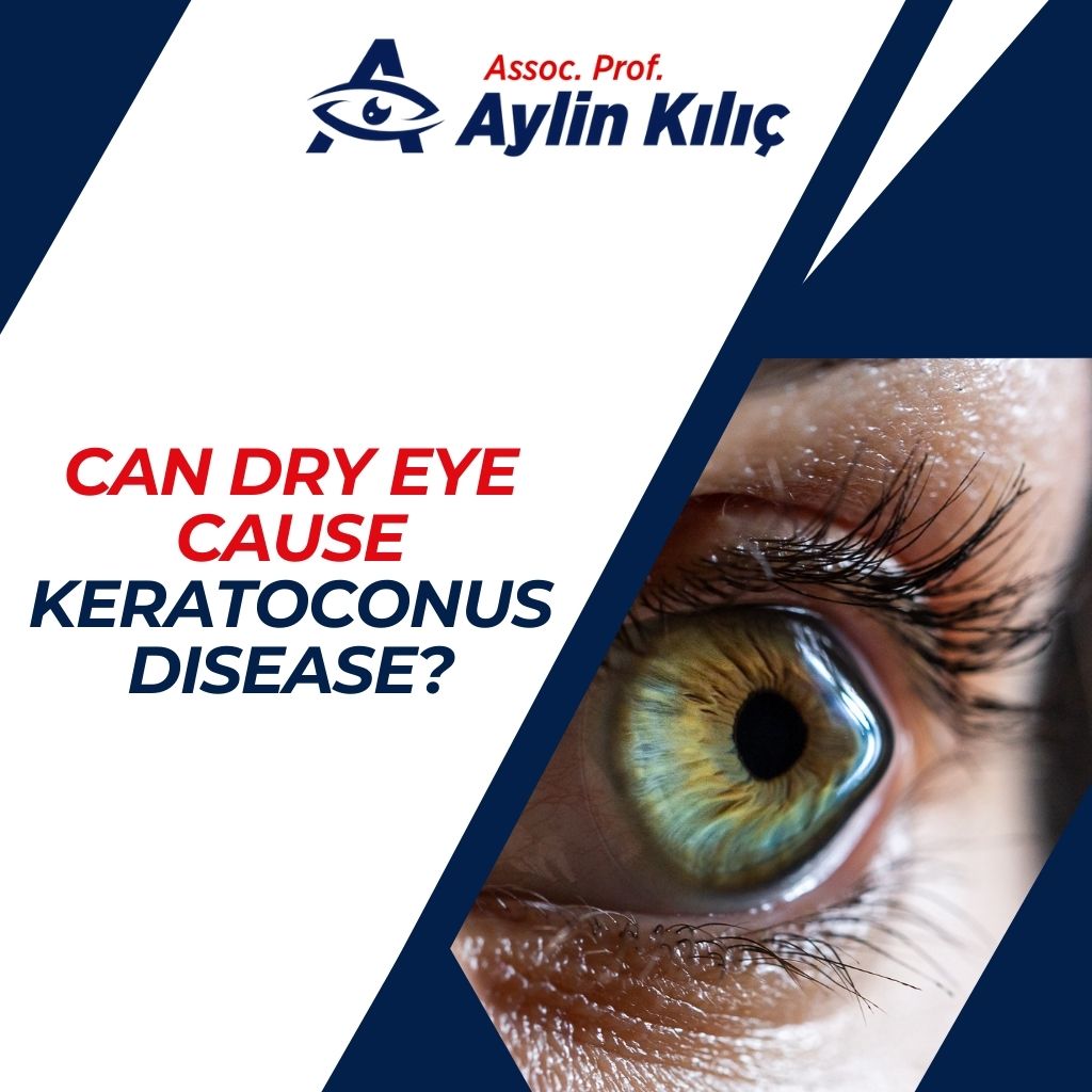 Can Dry Eye Cause Keratoconus Disease