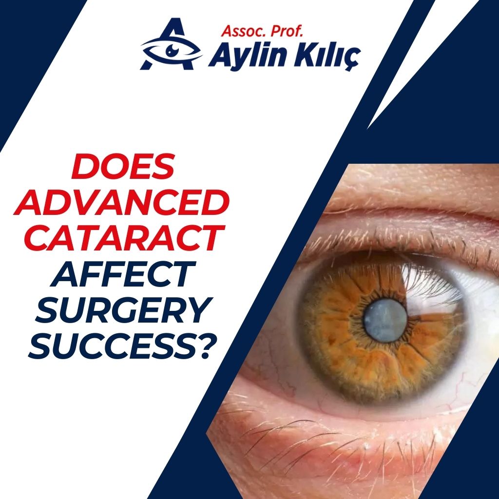 Does Advanced Cataract Affect Surgery Success