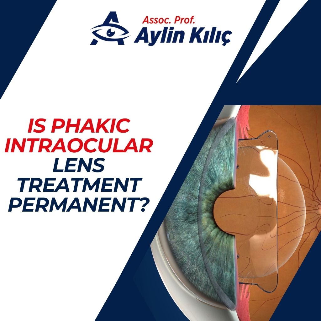 Is Phakic Intraocular Lens Treatment Permanent?