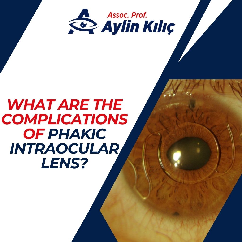 What are the Complications of Phakic Intraocular Lens?