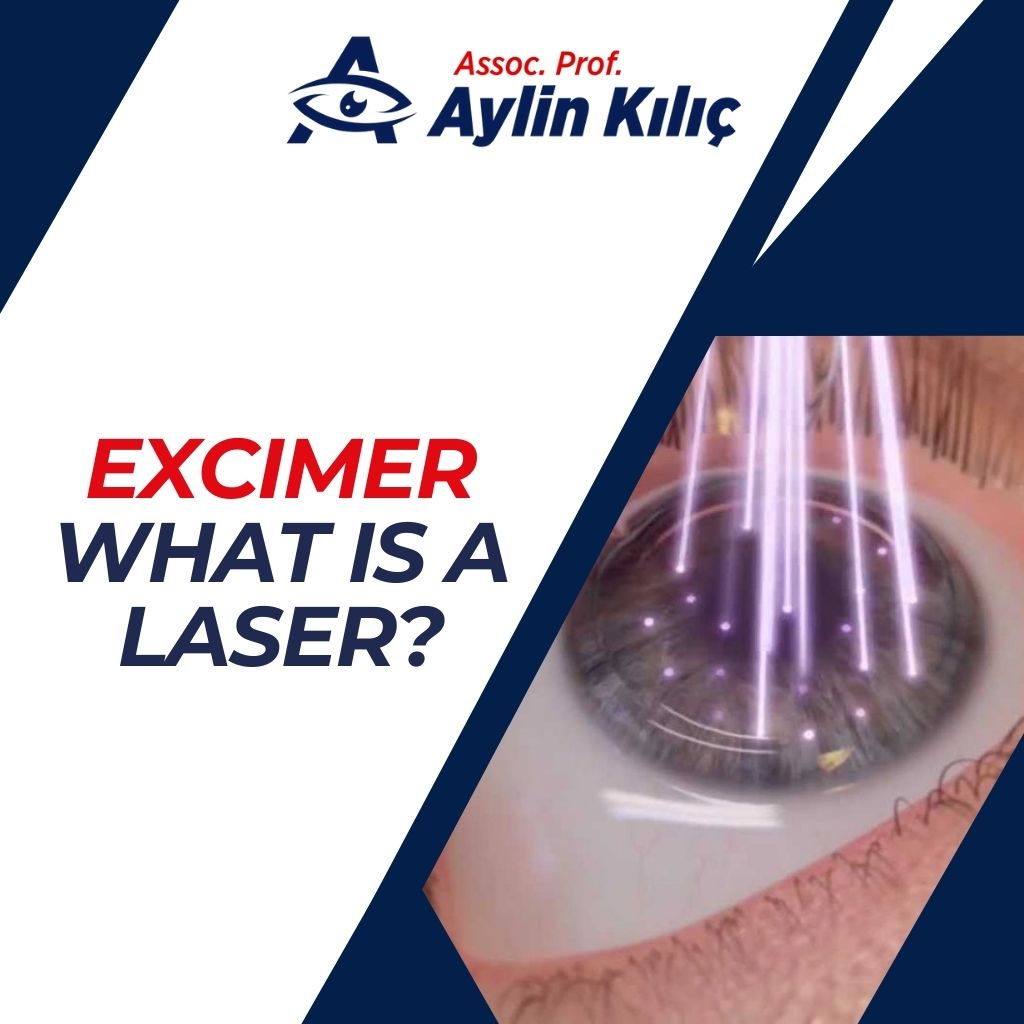 Excimer What is a Laser