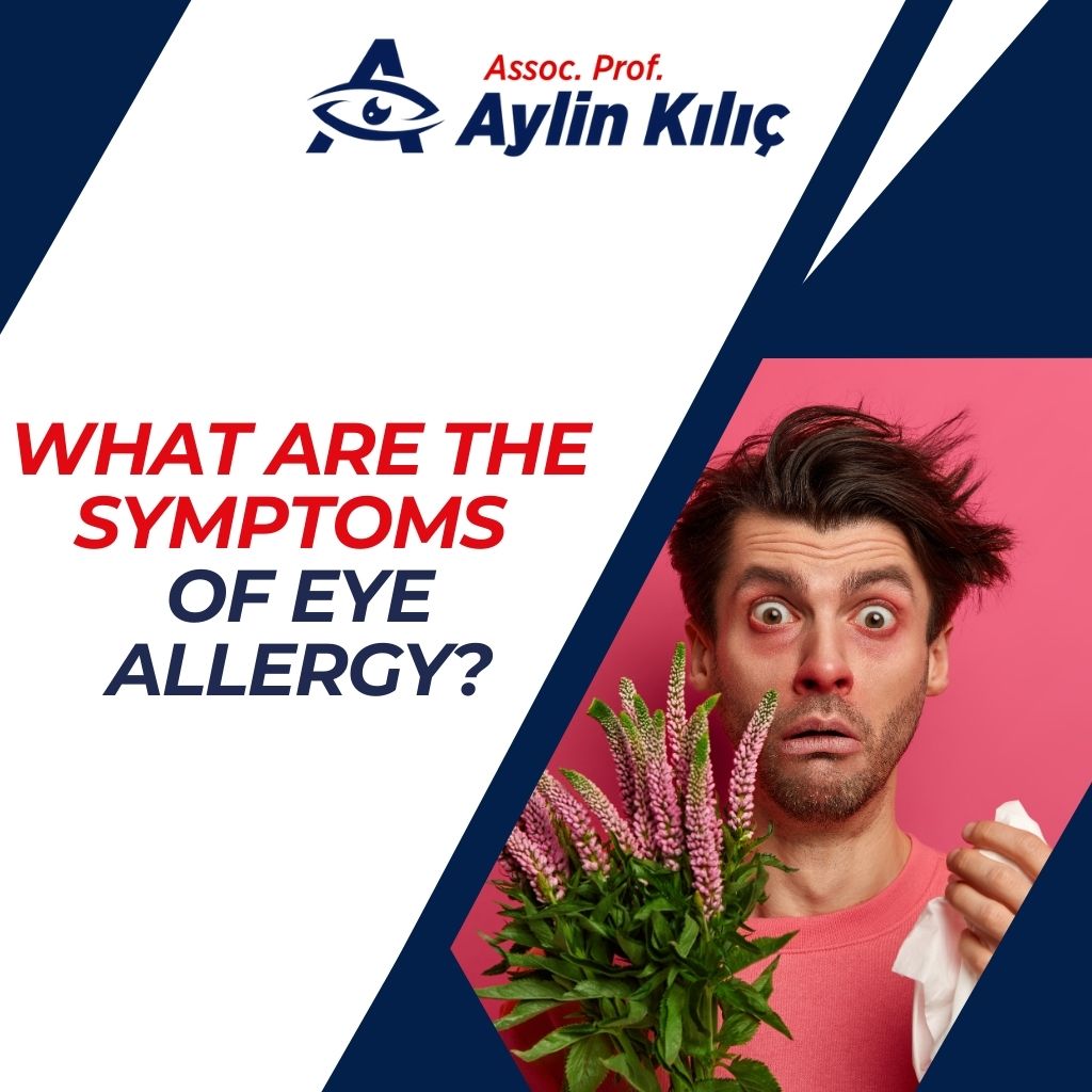 What are the Symptoms of Eye Allergy